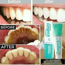 𝐃𝐞𝐧𝐭𝐢𝐟𝐫𝐢𝐜𝐞 𝐑é𝐯𝐨𝐥𝐮𝐭𝐢𝐨𝐧𝐧𝐚𝐢𝐫𝐞 𝐋𝐨𝐧𝐠𝐫𝐢𝐜𝐡  (𝟏 𝐚𝐜𝐡𝐞𝐭é = 𝟏 𝐛𝐨𝐢𝐭𝐞 𝐨𝐟𝐟𝐞𝐫𝐭𝐞)